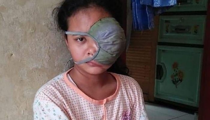 Nabila Mesti Kemo Kanker, Tapi Kekurangan Biaya