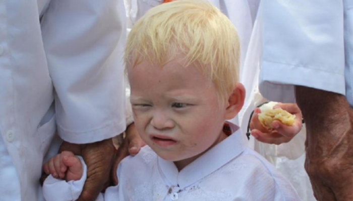 Ciburuy, “Kampung Albino” di Garut dengan Penduduknya Mirip Bule