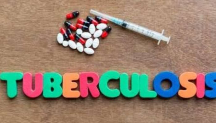 Dokter Kurang, Salah Satu Penyebab Tingginya Kasus Tubercolosis di Garut