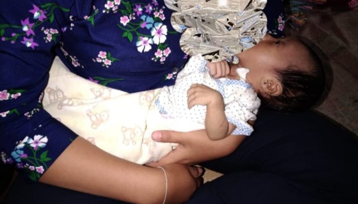 Tak Ada Biaya, Bayi Empat Bulan di Pamulihan Tak Bisa Berobat