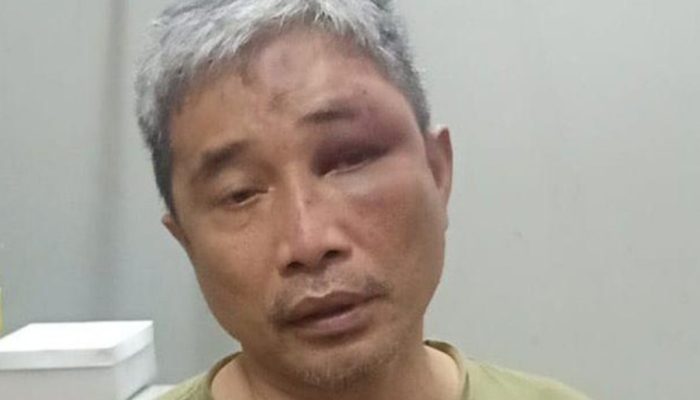 Muhammad Kece Diduga Dianiaya Irjen Napoleon Saat Malam Pertama Mendekam di Rutan