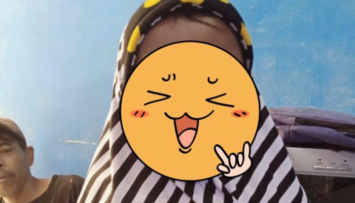 Bocah Penderita Labioplatoschizis dan Anophthalmia di Pamulihan Segera Jalani Operasi