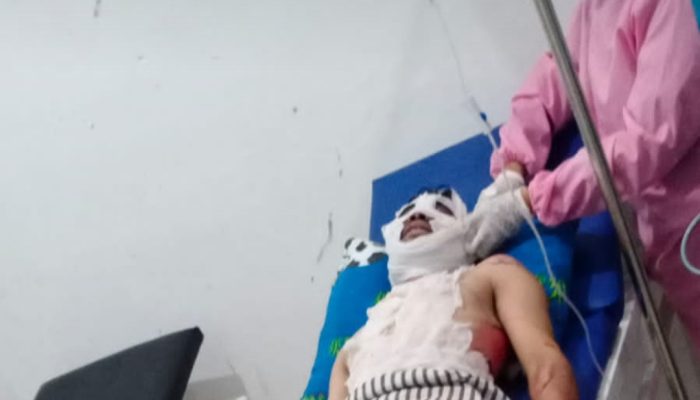 Rumah di Bungbulang Terbakar, Sang Istri Meninggal dan Seorang Lainnya Alami Luka Bakar
