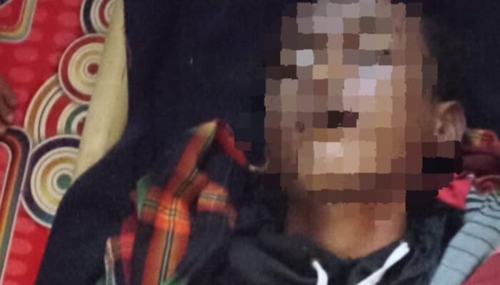 Remaja di Garut Tersambar Petir Saat Bermain di Pesawahan, Tubuhnya Alami Luka Bakar